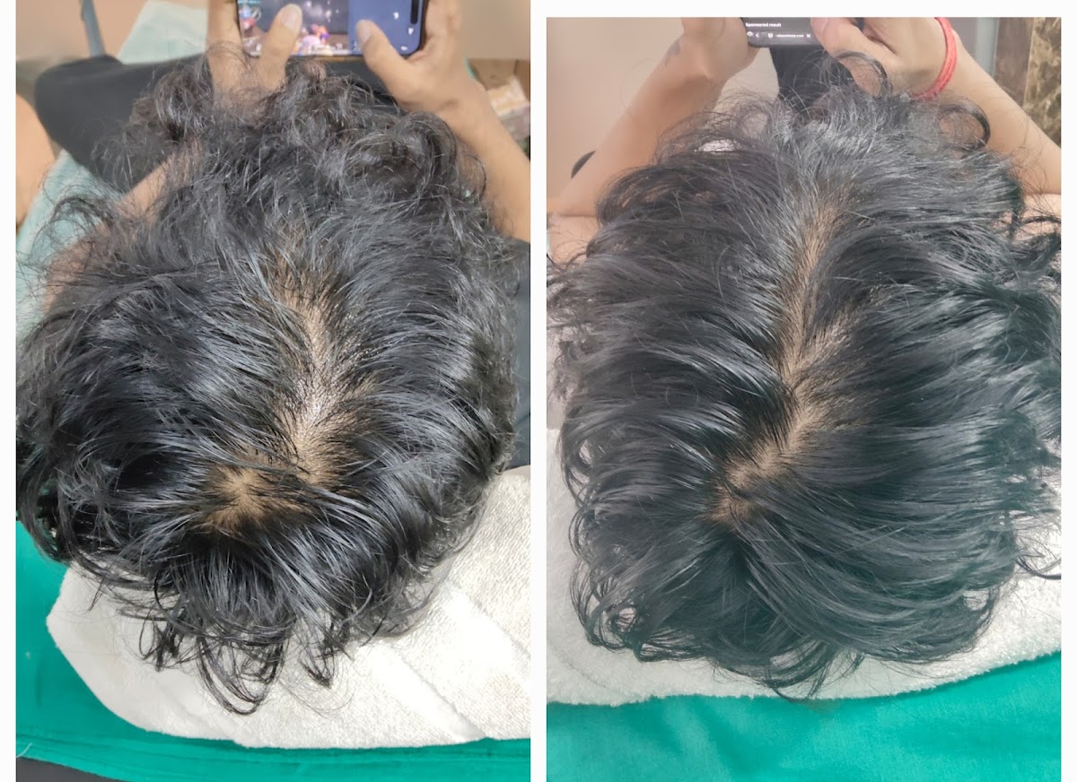 Dr Disha's Hair & Skin Clinic - Clinic in Cantonment, 