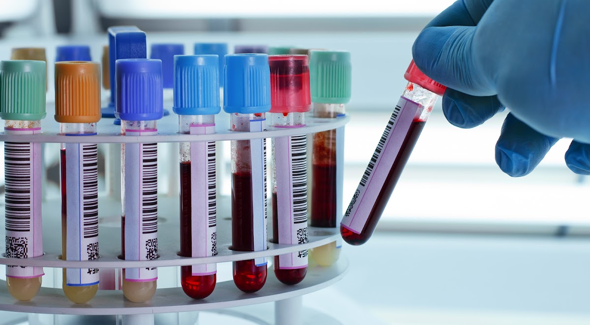 Vimal Diagnostic Centre - Diagnostic Centres in Alambagh, 