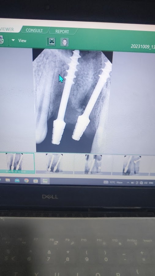 The Dental Clinic And Implant Center - Dentist in Alambagh, 